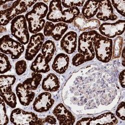 Invitrogen AKTIP Polyclonal Antibody 100 &mu;L; Unconjugated:Antibodies,