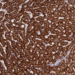 Invitrogen AKTIP Polyclonal Antibody 100 &mu;L; Unconjugated:Antibodies,
