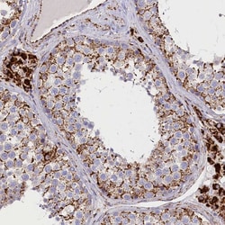 Invitrogen AKTIP Polyclonal Antibody 100 &mu;L; Unconjugated:Antibodies,