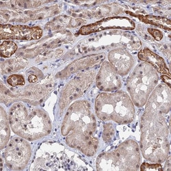 Invitrogen TSSC4 Polyclonal Antibody 100 &mu;L; Unconjugated:Antibodies,