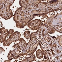 Invitrogen IST1 Polyclonal Antibody 100 &mu;L; Unconjugated:Antibodies,