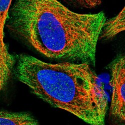 Invitrogen C16orf93 Polyclonal Antibody 100 &mu;L; Unconjugated:Antibodies,