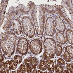 Invitrogen IFT122 Polyclonal Antibody 100 &mu;L; Unconjugated:Antibodies,