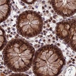 Invitrogen POLR2C Polyclonal Antibody 100 &mu;L; Unconjugated:Antibodies,