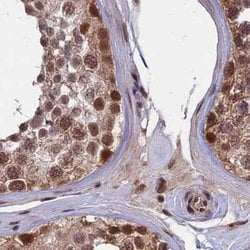 Invitrogen POLR2C Polyclonal Antibody 100 &mu;L; Unconjugated:Antibodies,