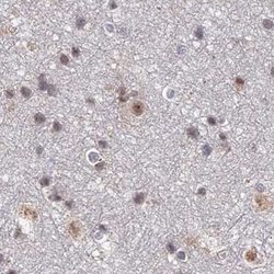 Invitrogen POLR2C Polyclonal Antibody 100 &mu;L; Unconjugated:Antibodies,