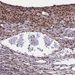 Invitrogen POLR2C Polyclonal Antibody 100 &mu;L; Unconjugated:Antibodies,