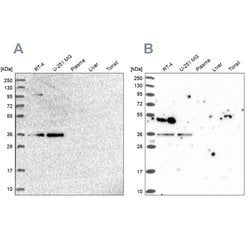Invitrogen POLR2C Polyclonal Antibody 100 &mu;L; Unconjugated:Antibodies,