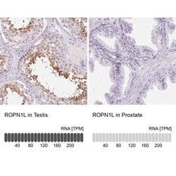 Invitrogen ROPN1L Polyclonal Antibody 100 &mu;L | Buy Online | Invitrogen&trade; | Fisher Scientific