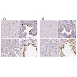 Invitrogen ROPN1L Polyclonal Antibody 100 &mu;L | Buy Online | Invitrogen&trade; | Fisher Scientific