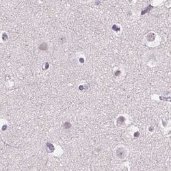 Invitrogen ROPN1L Polyclonal Antibody 100 &mu;L | Buy Online | Invitrogen&trade; | Fisher Scientific