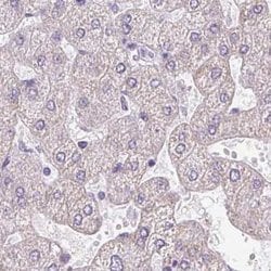 Invitrogen ROPN1L Polyclonal Antibody 100 &mu;L | Buy Online | Invitrogen&trade; | Fisher Scientific