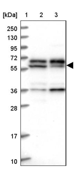 Invitrogen C15orf52 Polyclonal Antibody 100 &mu;L; Unconjugated:Antibodies,