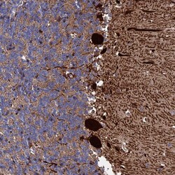Invitrogen PMSCL1 Polyclonal Antibody 100 &mu;L; Unconjugated:Antibodies,