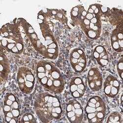 Invitrogen PPP1R14D Polyclonal Antibody 100 &mu;L; Unconjugated:Antibodies,