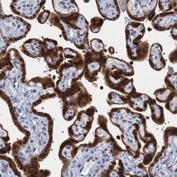 Invitrogen EPS8L1 Polyclonal Antibody 100 &mu;L; Unconjugated:Antibodies,