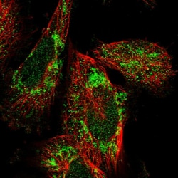 Invitrogen C19orf52 Polyclonal Antibody 100 &mu;L; Unconjugated:Antibodies,