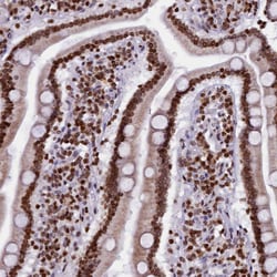 Invitrogen C19orf52 Polyclonal Antibody 100 &mu;L; Unconjugated:Antibodies,