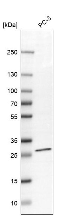 Invitrogen C19orf52 Polyclonal Antibody 100 &mu;L | Buy Online | Invitrogen&trade; | Fisher Scientific