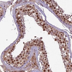 Invitrogen C3orf70 Polyclonal Antibody 100 &mu;L; Unconjugated:Antibodies,