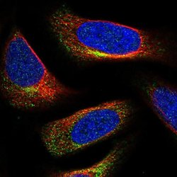 Invitrogen C3orf70 Polyclonal Antibody 100 &mu;L; Unconjugated:Antibodies,
