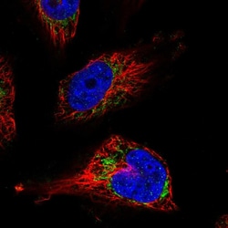 Invitrogen UQCRFS1 Polyclonal Antibody 100 &mu;L; Unconjugated:Antibodies,