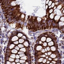 Invitrogen UQCRFS1 Polyclonal Antibody 100 &mu;L; Unconjugated:Antibodies,