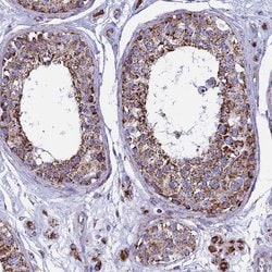 Invitrogen UQCRFS1 Polyclonal Antibody 100 &mu;L; Unconjugated:Antibodies,