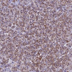 Invitrogen UQCRFS1 Polyclonal Antibody 100 &mu;L; Unconjugated:Antibodies,