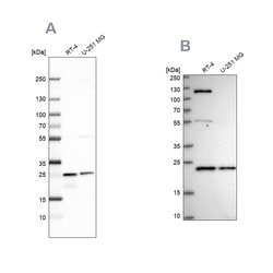 Invitrogen UQCRFS1 Polyclonal Antibody 100 &mu;L; Unconjugated:Antibodies,