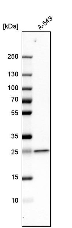 Invitrogen UQCRFS1 Polyclonal Antibody 100 &mu;L; Unconjugated:Antibodies,