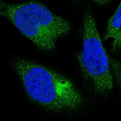 Invitrogen PPP4R4 Polyclonal Antibody 100 &mu;L; Unconjugated:Antibodies,