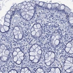 Invitrogen RHCG Polyclonal Antibody 100 &mu;L; Unconjugated:Antibodies,