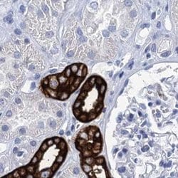 Invitrogen RHCG Polyclonal Antibody 100 &mu;L; Unconjugated:Antibodies,