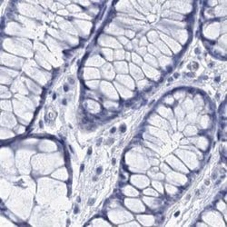 Invitrogen RHCG Polyclonal Antibody 100 &mu;L; Unconjugated:Antibodies,