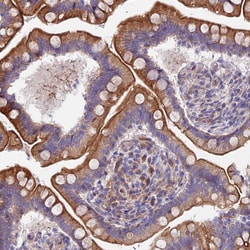 Invitrogen MVB12A Polyclonal Antibody 100 &mu;L; Unconjugated:Antibodies,