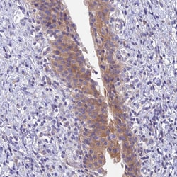 Invitrogen MVB12A Polyclonal Antibody 100 &mu;L; Unconjugated:Antibodies,