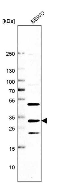 Invitrogen MVB12A Polyclonal Antibody 100 &mu;L; Unconjugated:Antibodies,
