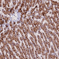 Invitrogen ZNF598 Polyclonal Antibody 100 &mu;L | Buy Online | Invitrogen&trade; | Fisher Scientific