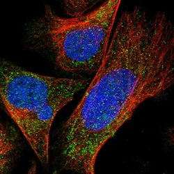 Invitrogen DDX28 Polyclonal Antibody 100 &mu;L; Unconjugated:Antibodies,