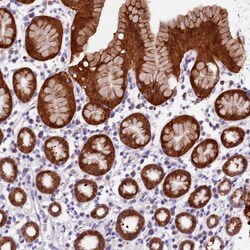 Invitrogen DDX28 Polyclonal Antibody 100 &mu;L; Unconjugated:Antibodies,