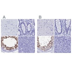 Invitrogen TEX101 Polyclonal Antibody 100 &mu;L; Unconjugated:Antibodies,