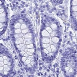 Invitrogen TEX101 Polyclonal Antibody 100 &mu;L; Unconjugated:Antibodies,