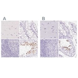 Invitrogen SPACA4 Polyclonal Antibody 100 &mu;L; Unconjugated:Antibodies,