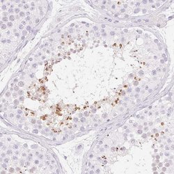 Invitrogen SPACA4 Polyclonal Antibody 100 &mu;L; Unconjugated:Antibodies,