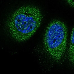Invitrogen EVA1B Polyclonal Antibody 100 &mu;L; Unconjugated:Antibodies,