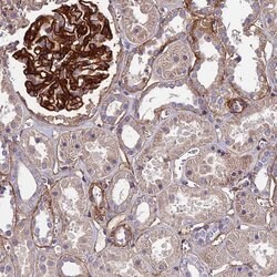 Invitrogen EVA1B Polyclonal Antibody 100 &mu;L; Unconjugated:Antibodies,