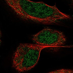 Invitrogen BTBD9 Polyclonal Antibody 100 &mu;L; Unconjugated:Antibodies,