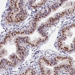 Invitrogen BTBD9 Polyclonal Antibody 100 &mu;L; Unconjugated:Antibodies,