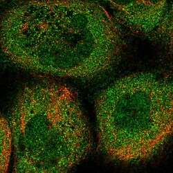 Invitrogen DOHH Polyclonal Antibody 100 &mu;L; Unconjugated:Antibodies,